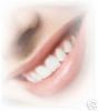 ชุดฟอกสีฟันขาว Million Dollar Smile  35 เปอร์เซ็นต์ พร้อม ถาดพิมพ์ปาก สำเร็จรูป และ แสงเลเซอร์