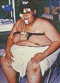 Body Fat