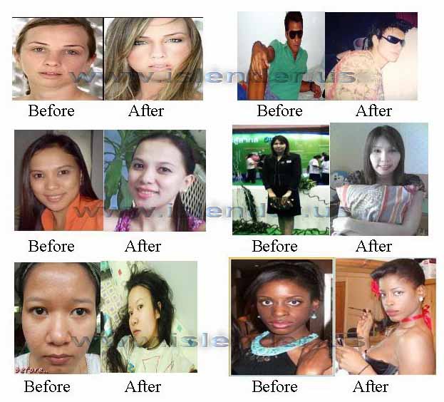 Skin Bleaching Before and After